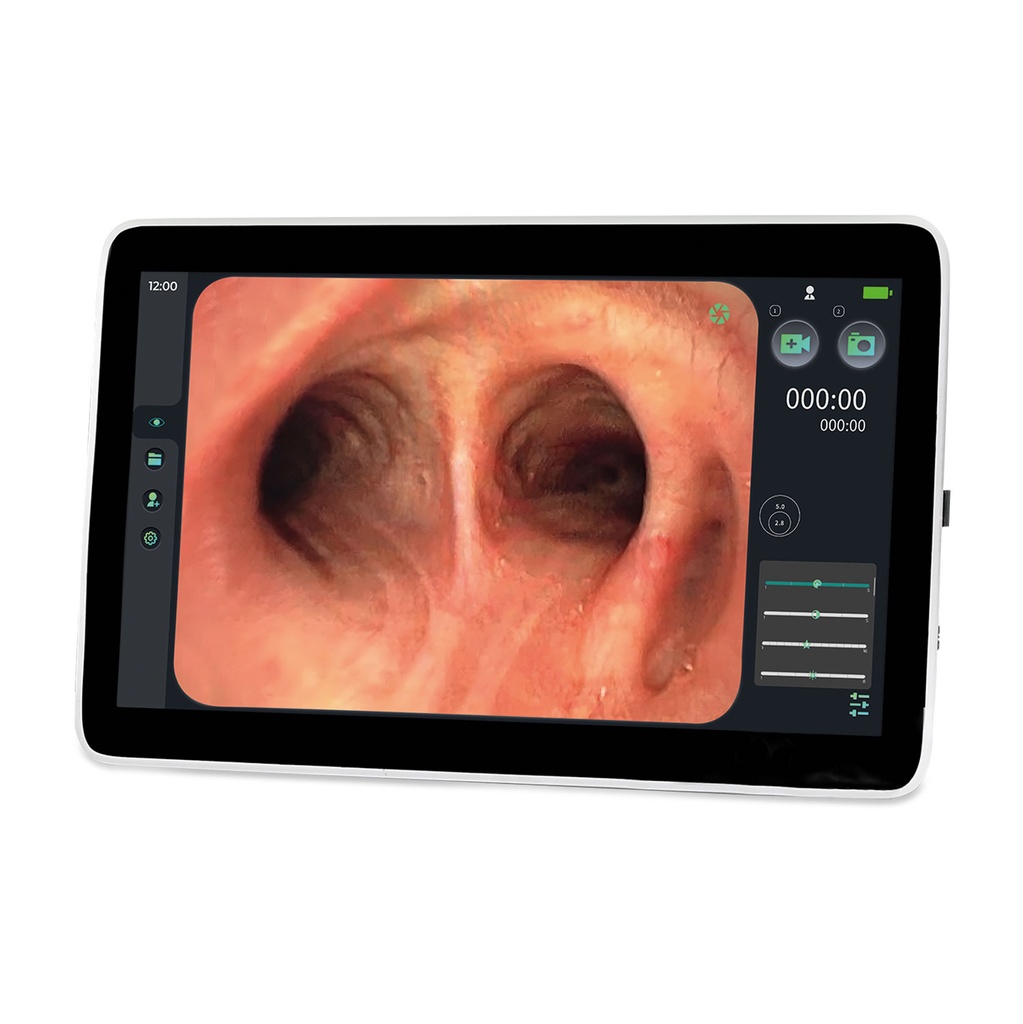 EickView SD endoszkópos monitor, 15,6" érintőképernyő