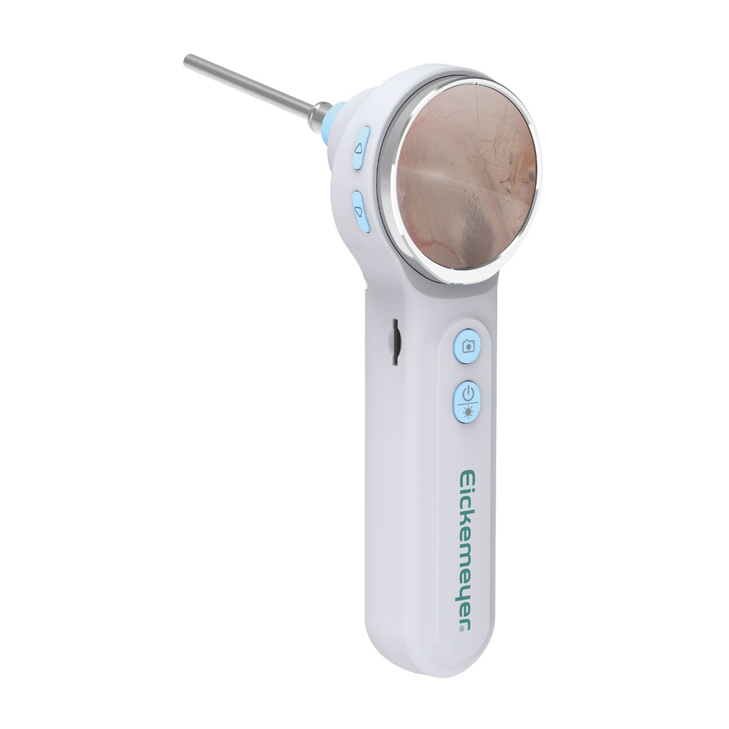 EickView OTO – Digitális videó otoszkóp