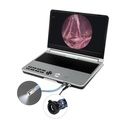 EickView 4-in-1 kompakt endoszkóp rendszer