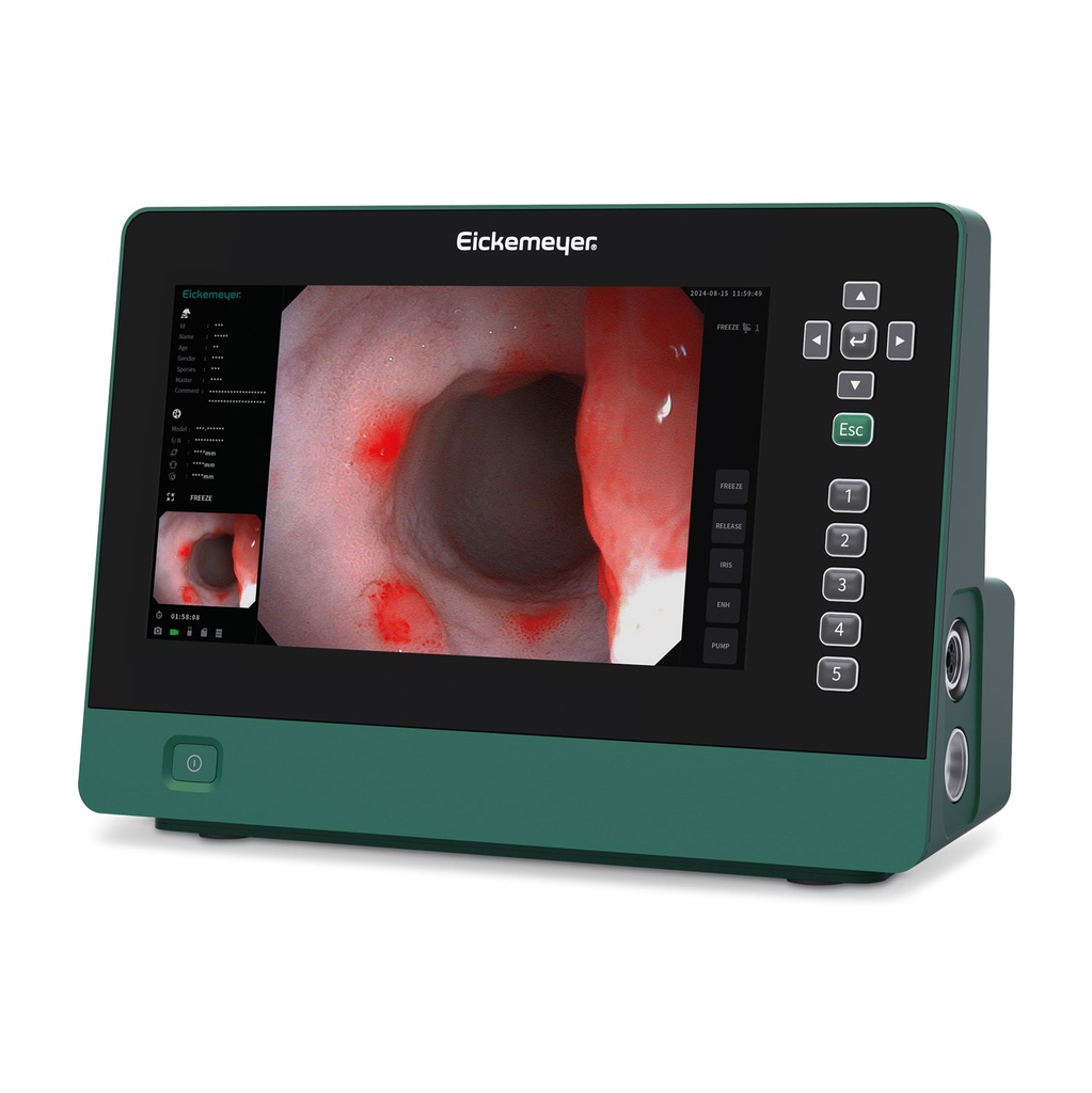 [306200] EickView 5-in-1 Endoszkóprendszer