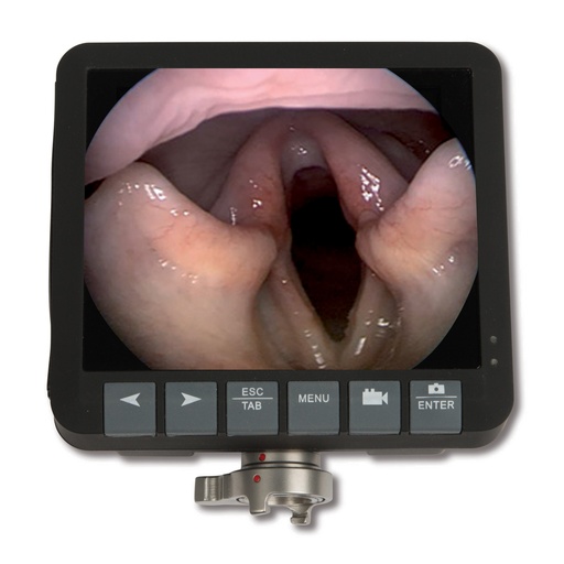 [30601004] 3,5"-os csatlakoztatható monitor EickView 60, 70, 100E és 150E endoszkópokhoz